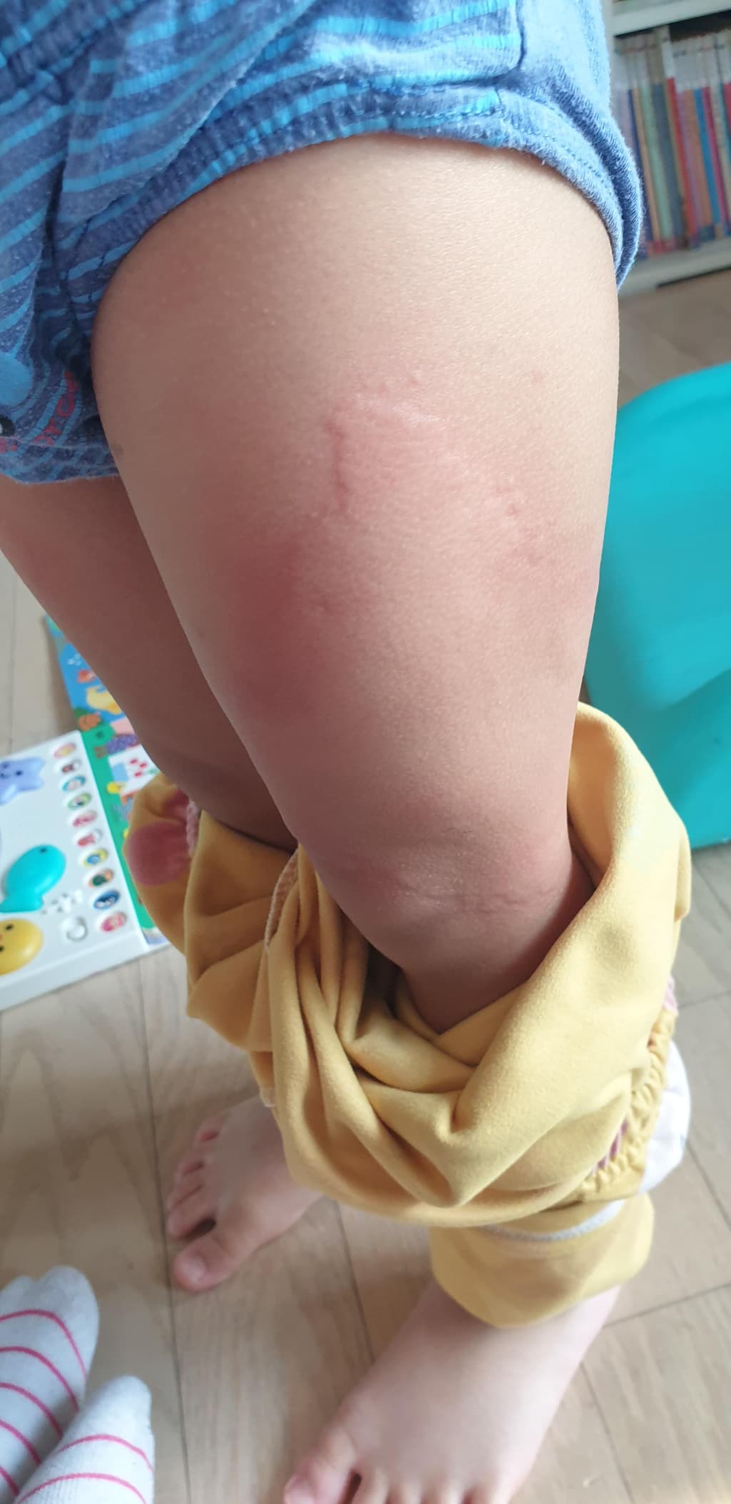 1번 째 사진