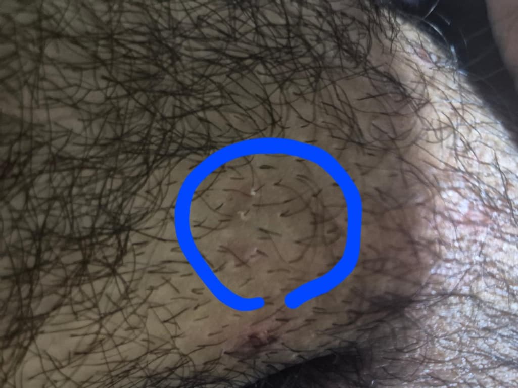 2번 째 사진