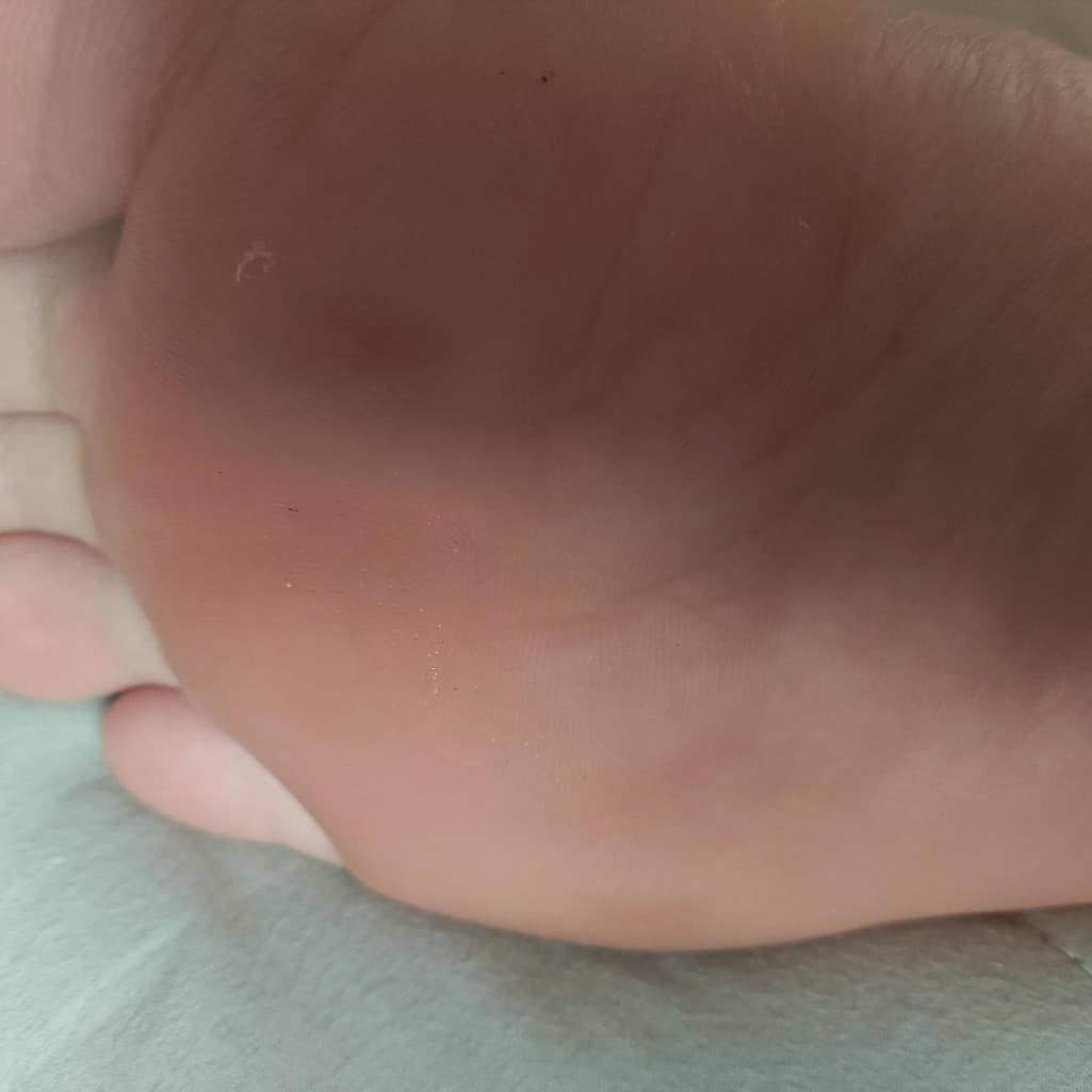 2번 째 사진