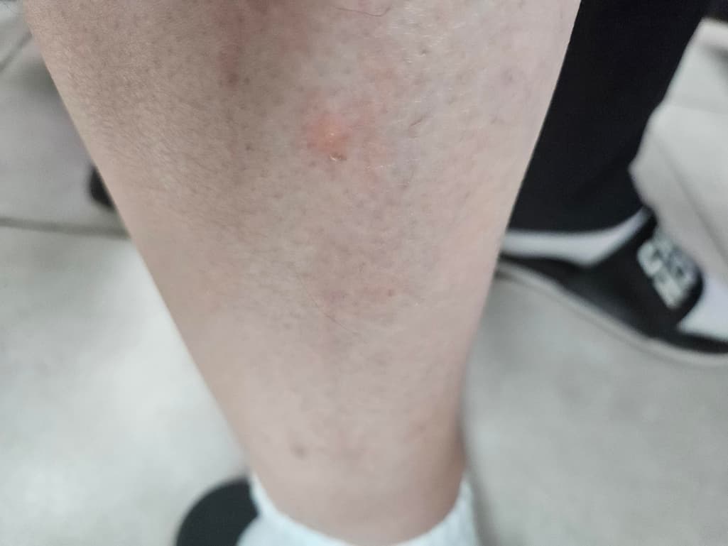 2번 째 사진
