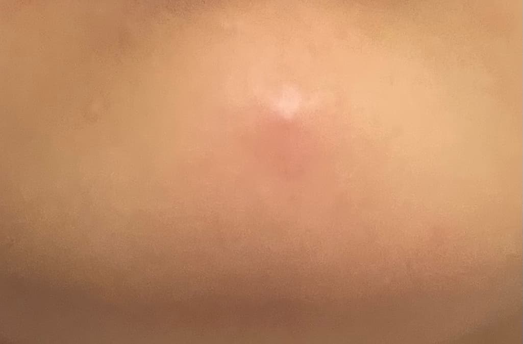 2번 째 사진