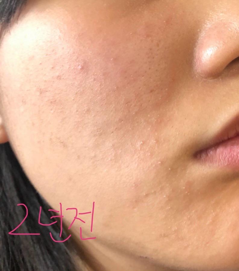 3번 째 사진