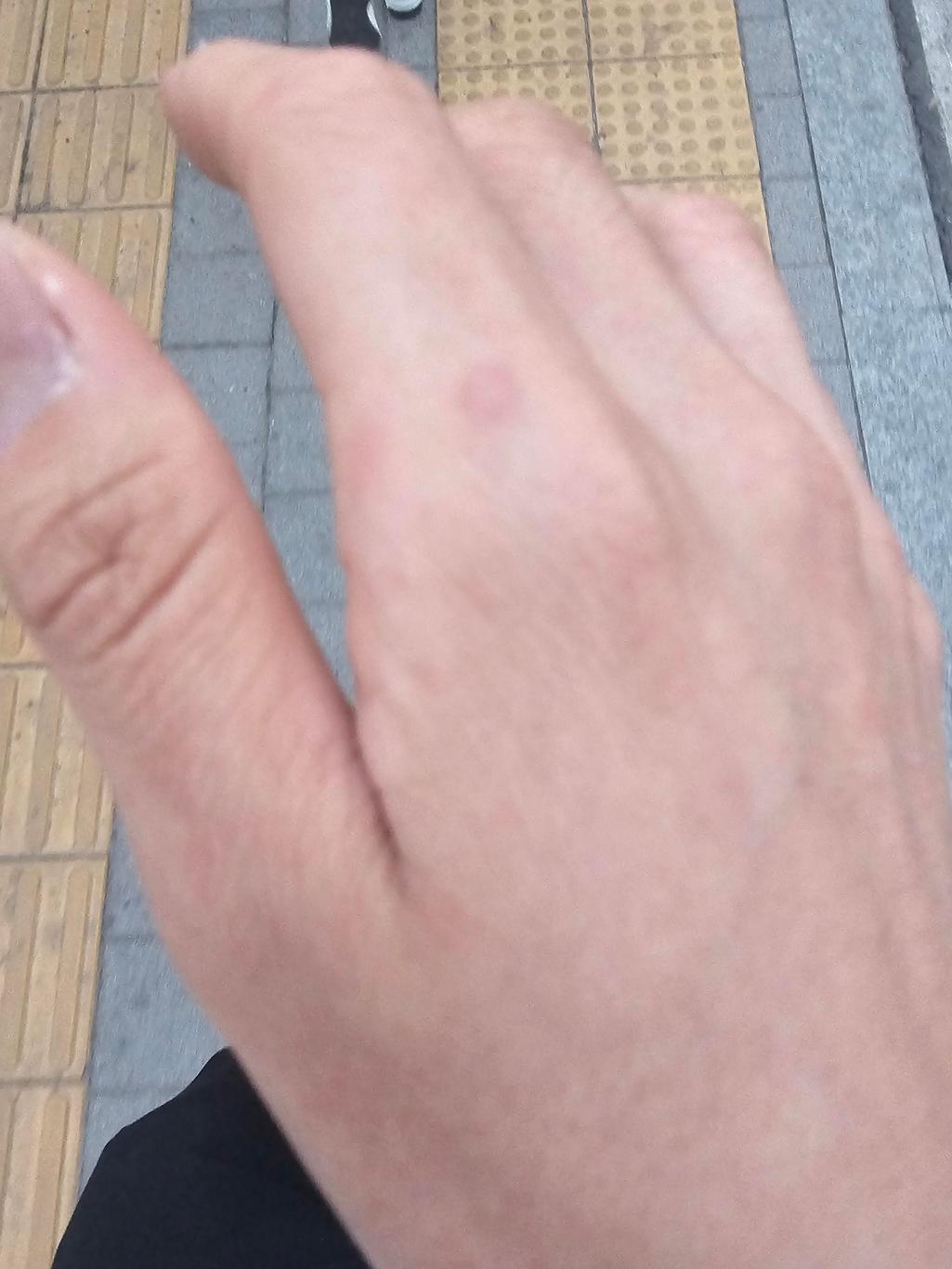 3번 째 사진