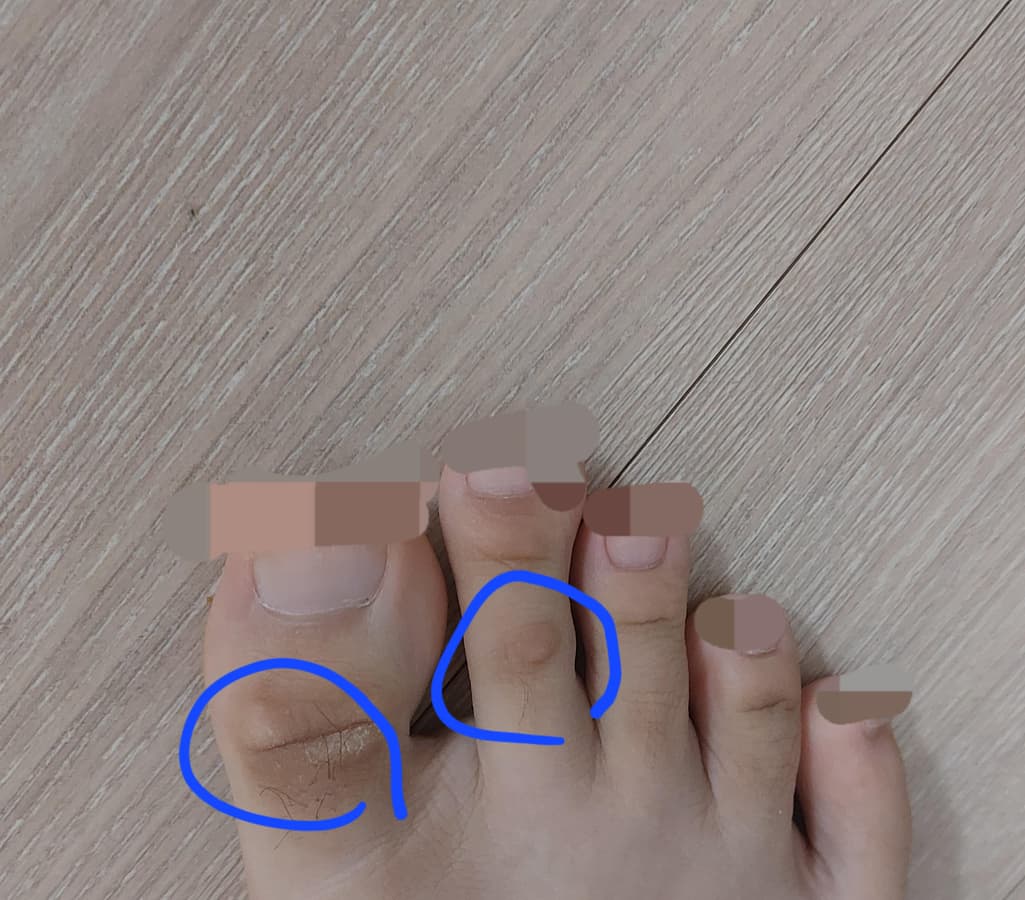 2번 째 사진