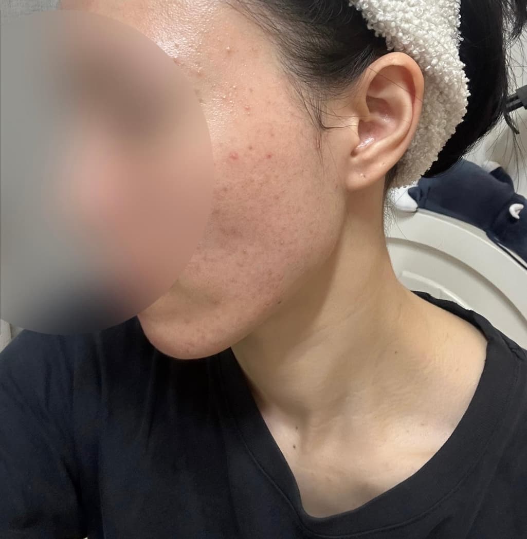 2번 째 사진