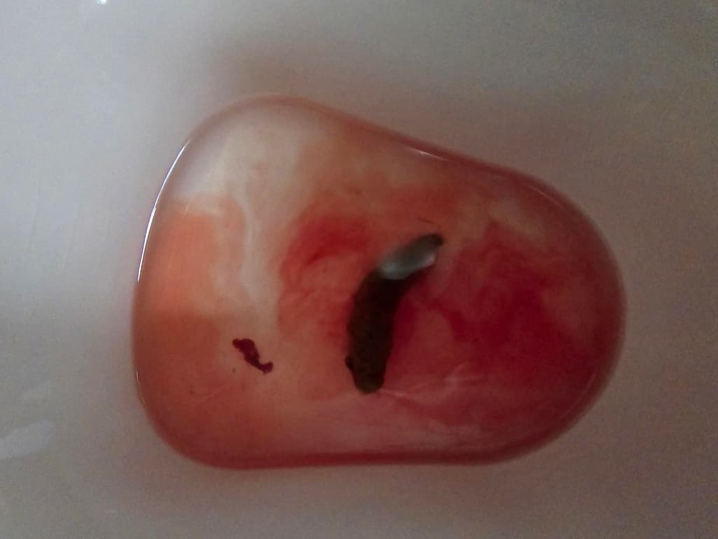 3번 째 사진