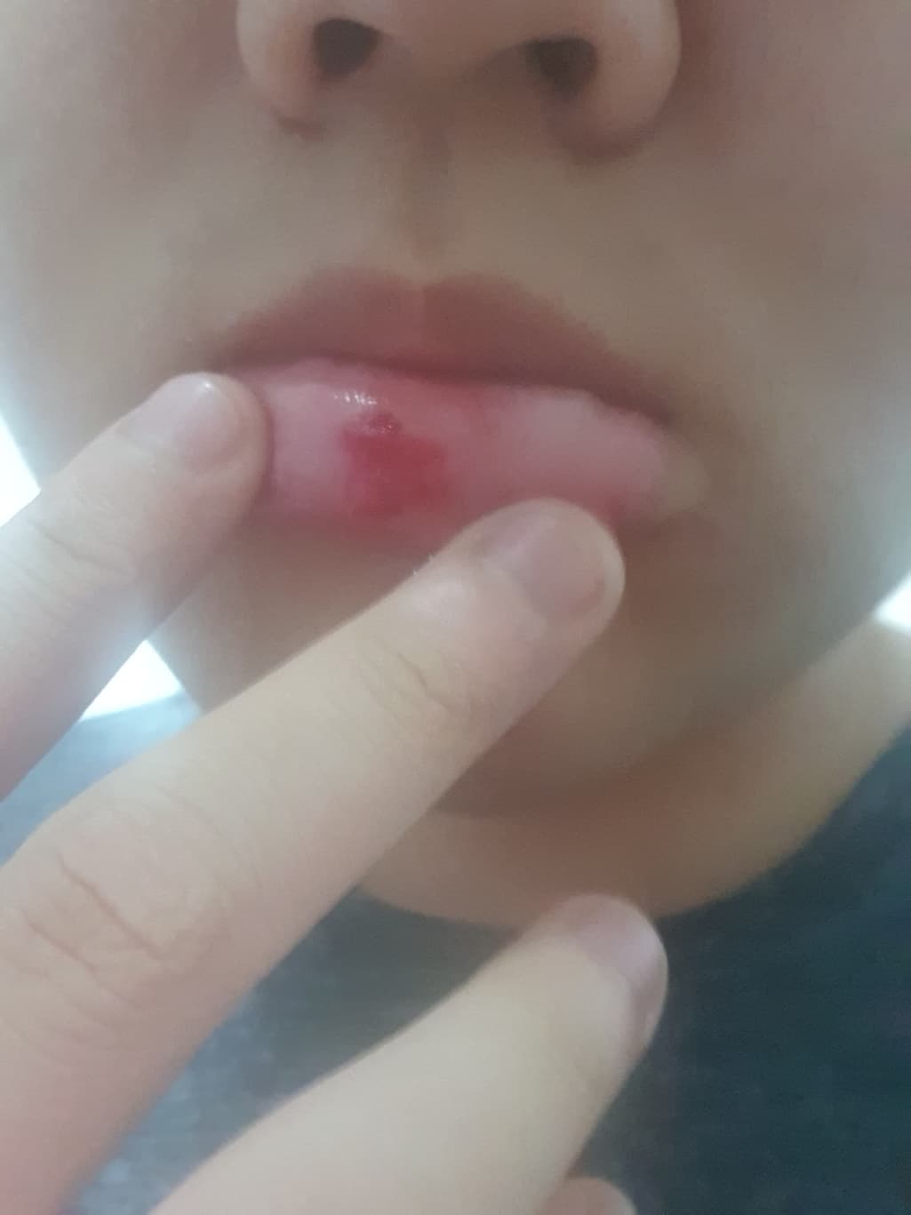 2번 째 사진