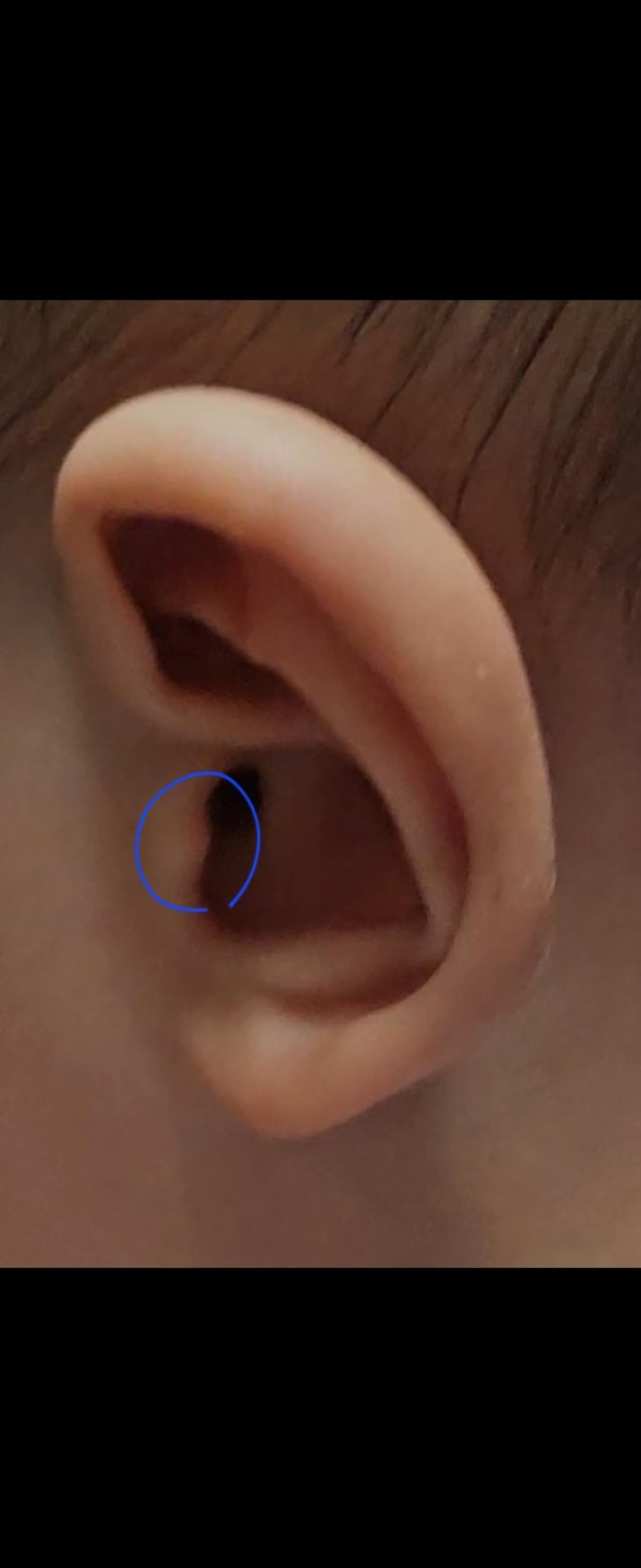 2번 째 사진