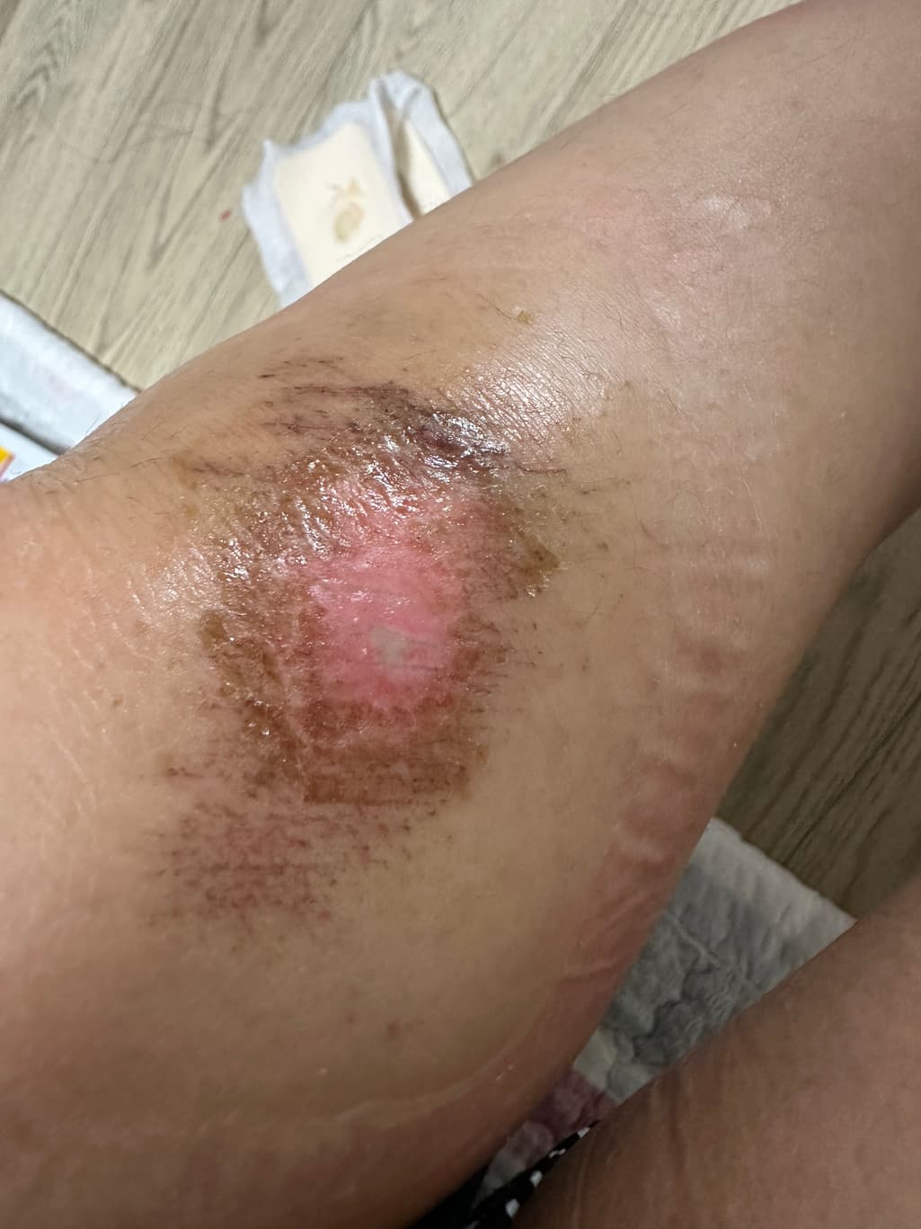 1번 째 사진