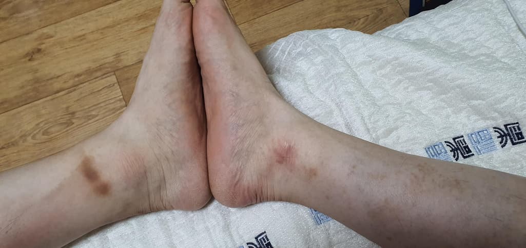 3번 째 사진