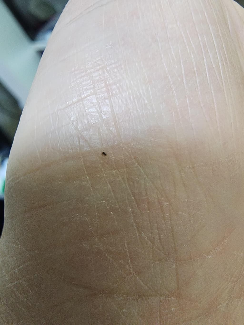 2번 째 사진