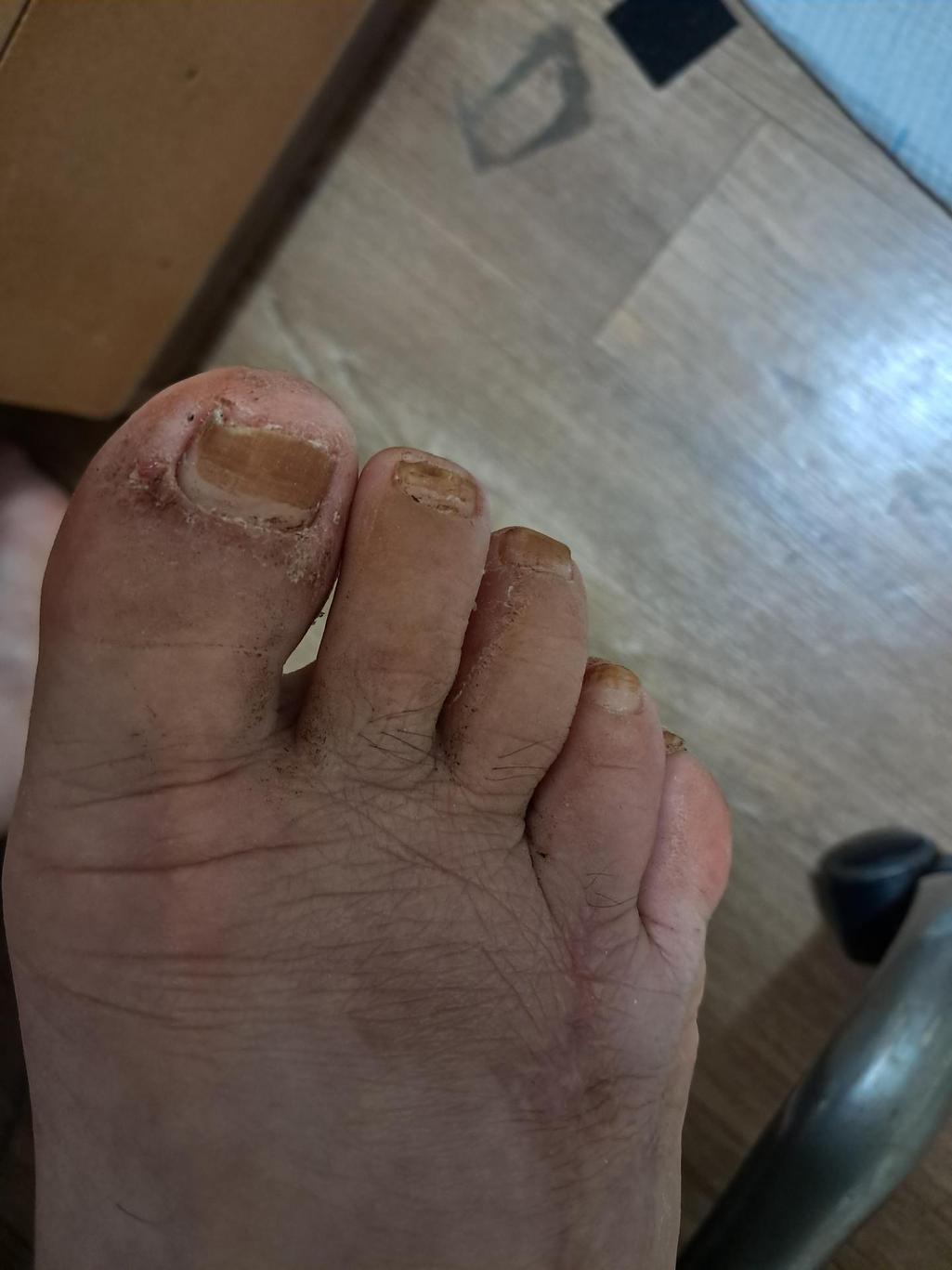 3번 째 사진