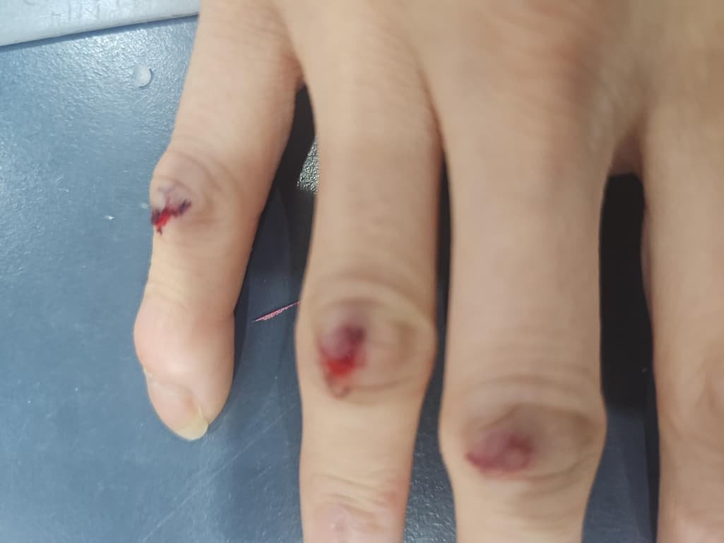 2번 째 사진