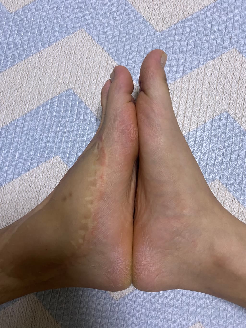 2번 째 사진