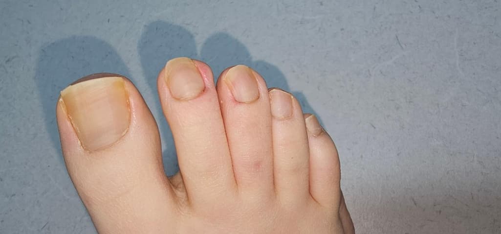 3번 째 사진