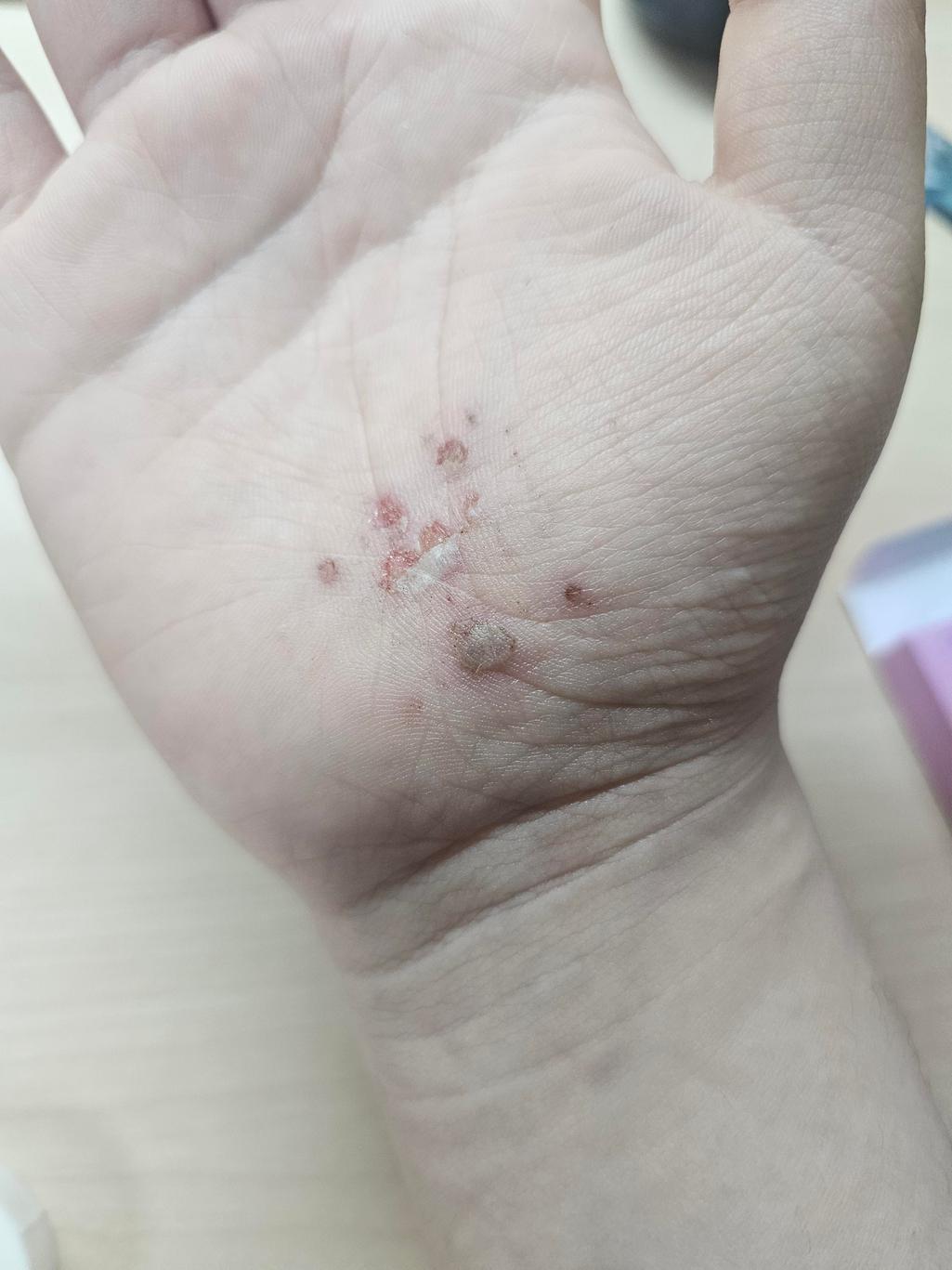 1번 째 사진