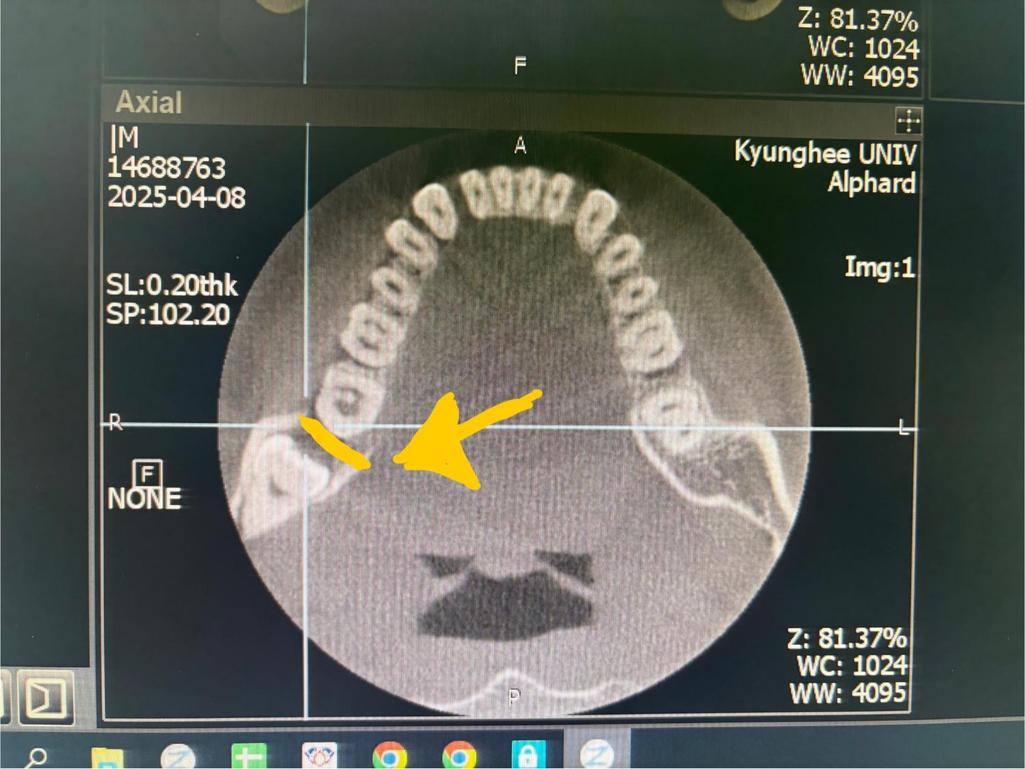 1번 째 사진