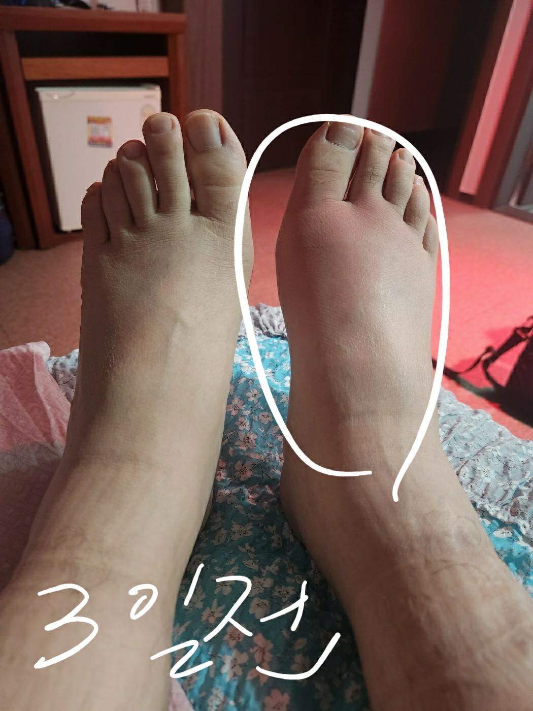 2번 째 사진