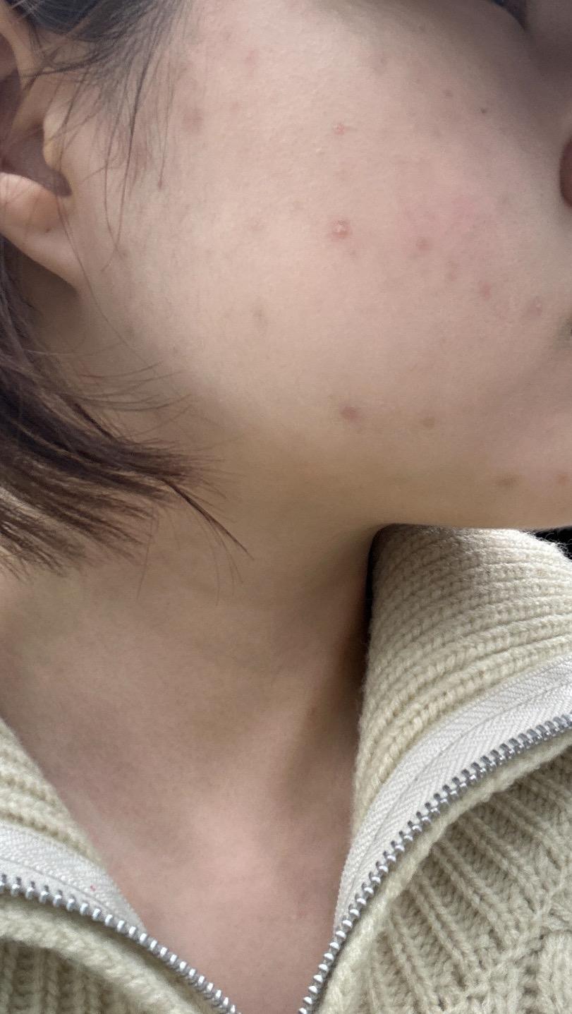 2번 째 사진