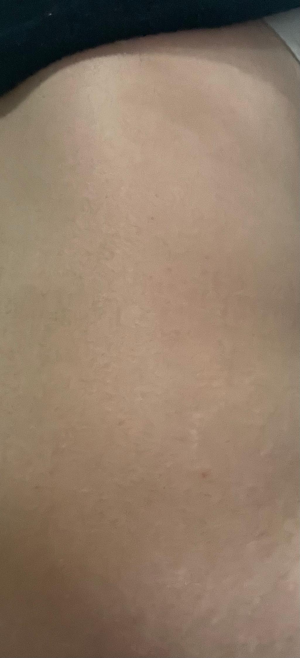 2번 째 사진