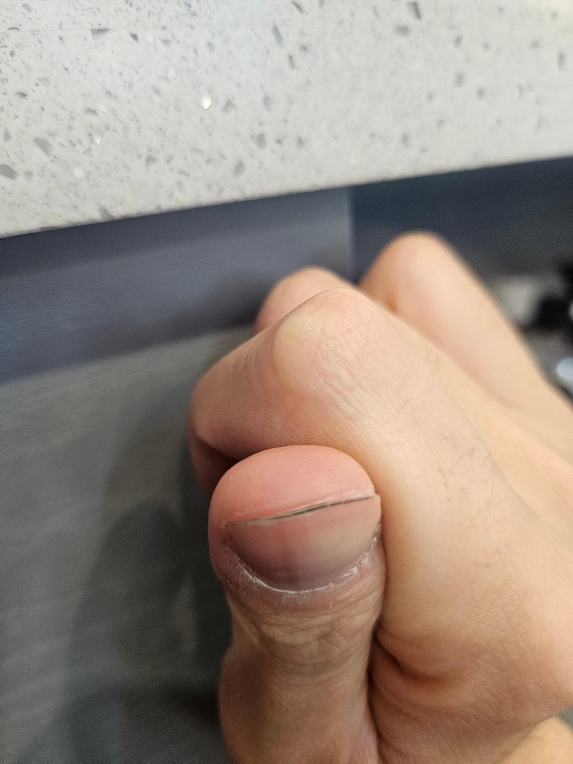 3번 째 사진