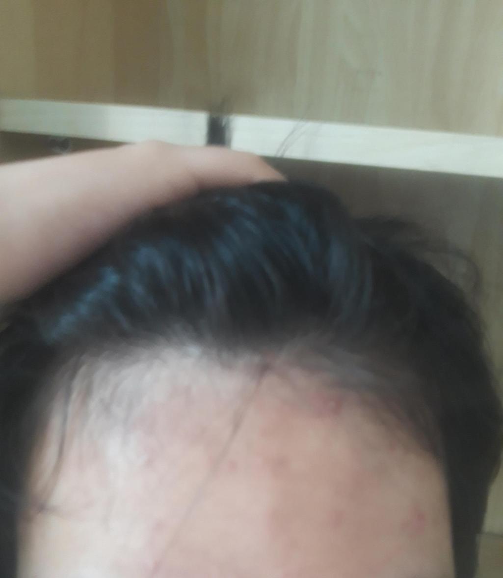 2번 째 사진