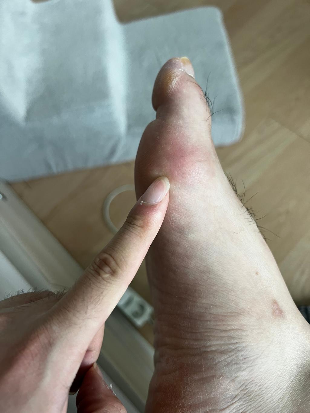2번 째 사진