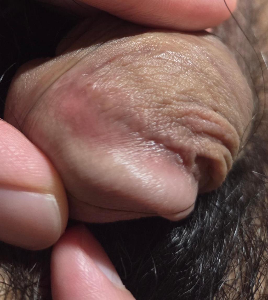 3번 째 사진
