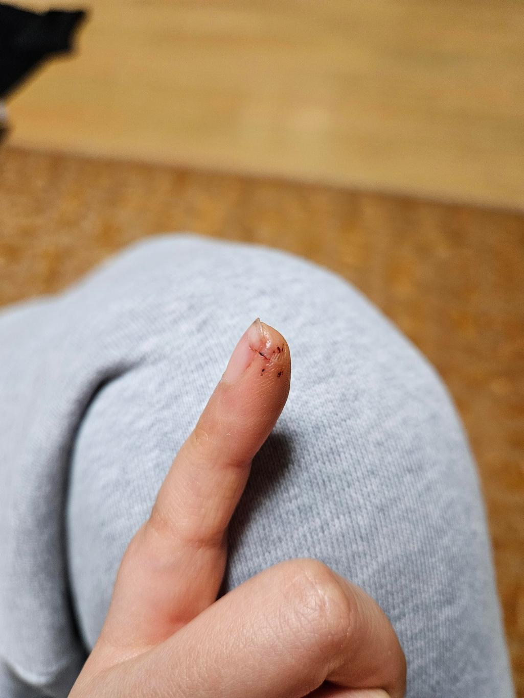 2번 째 사진