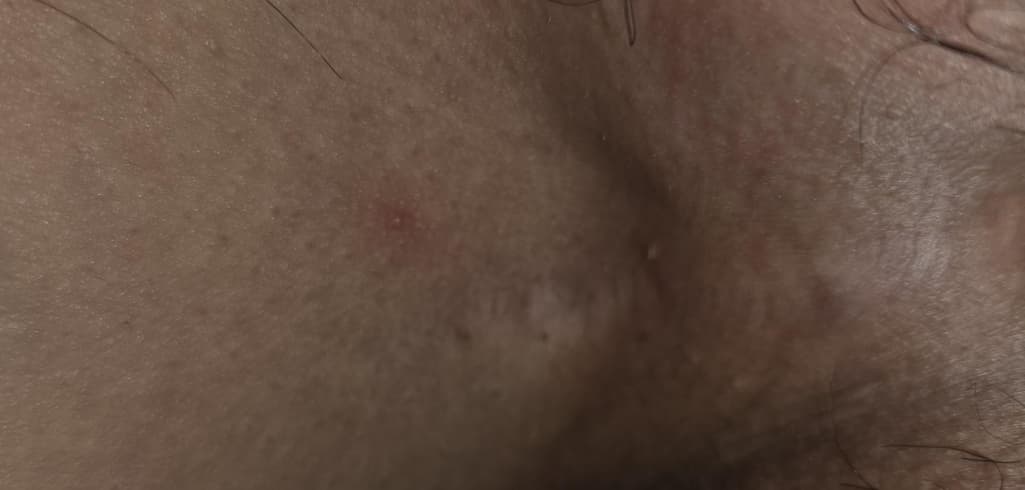 3번 째 사진
