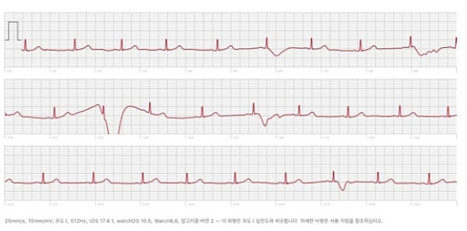 2번 째 사진