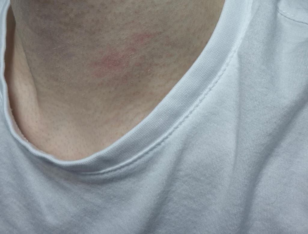 3번 째 사진