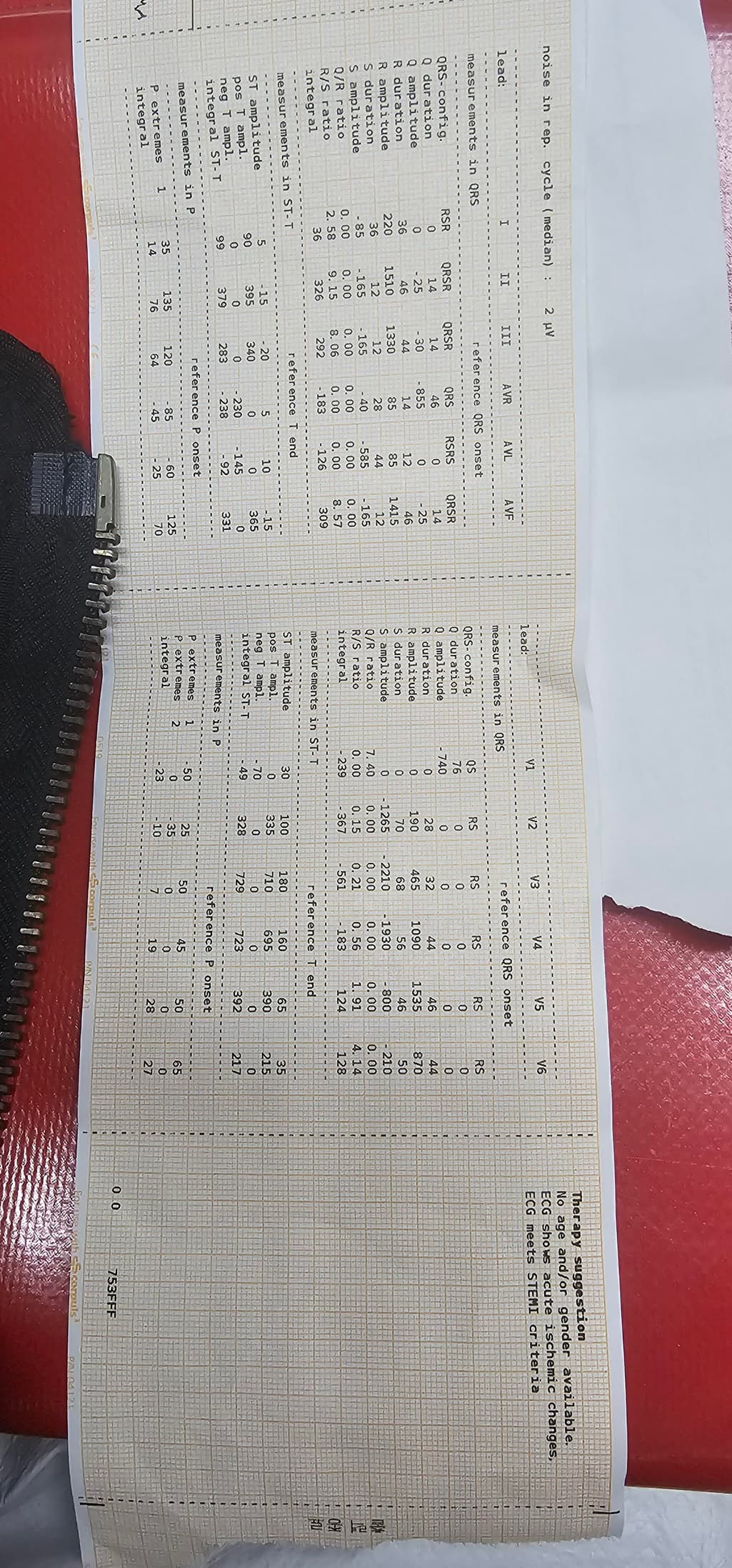2번 째 사진