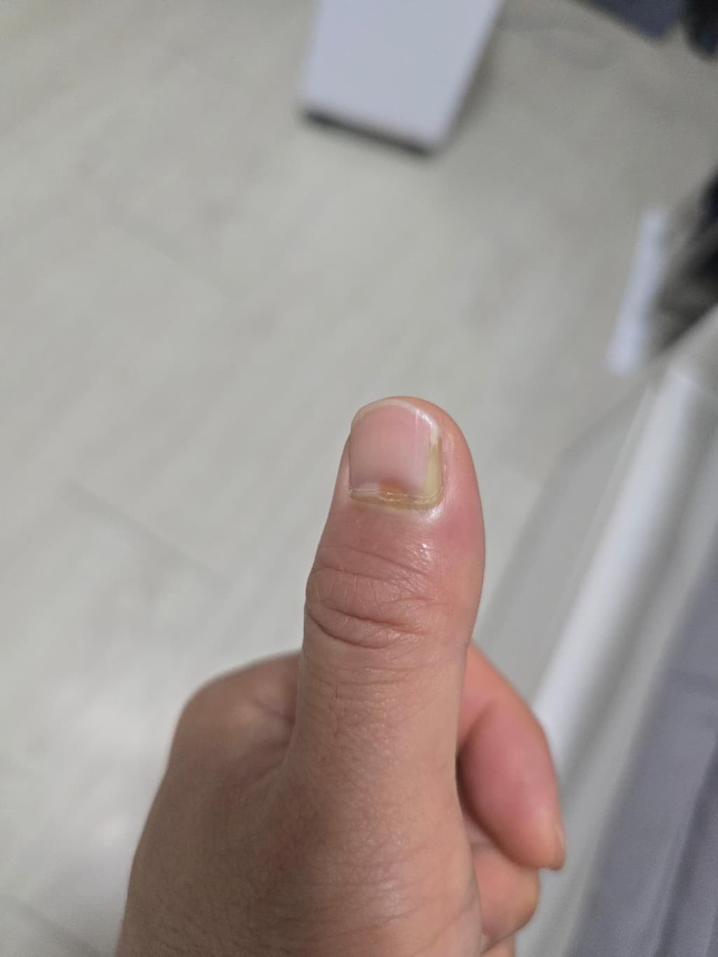 2번 째 사진
