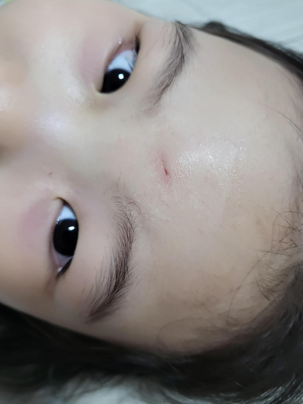 2번 째 사진