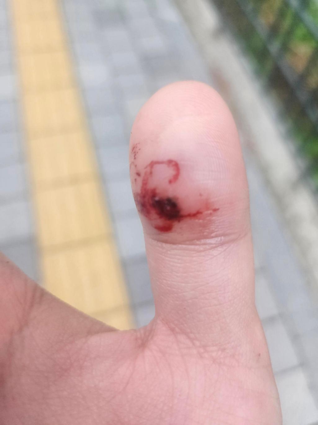 1번 째 사진