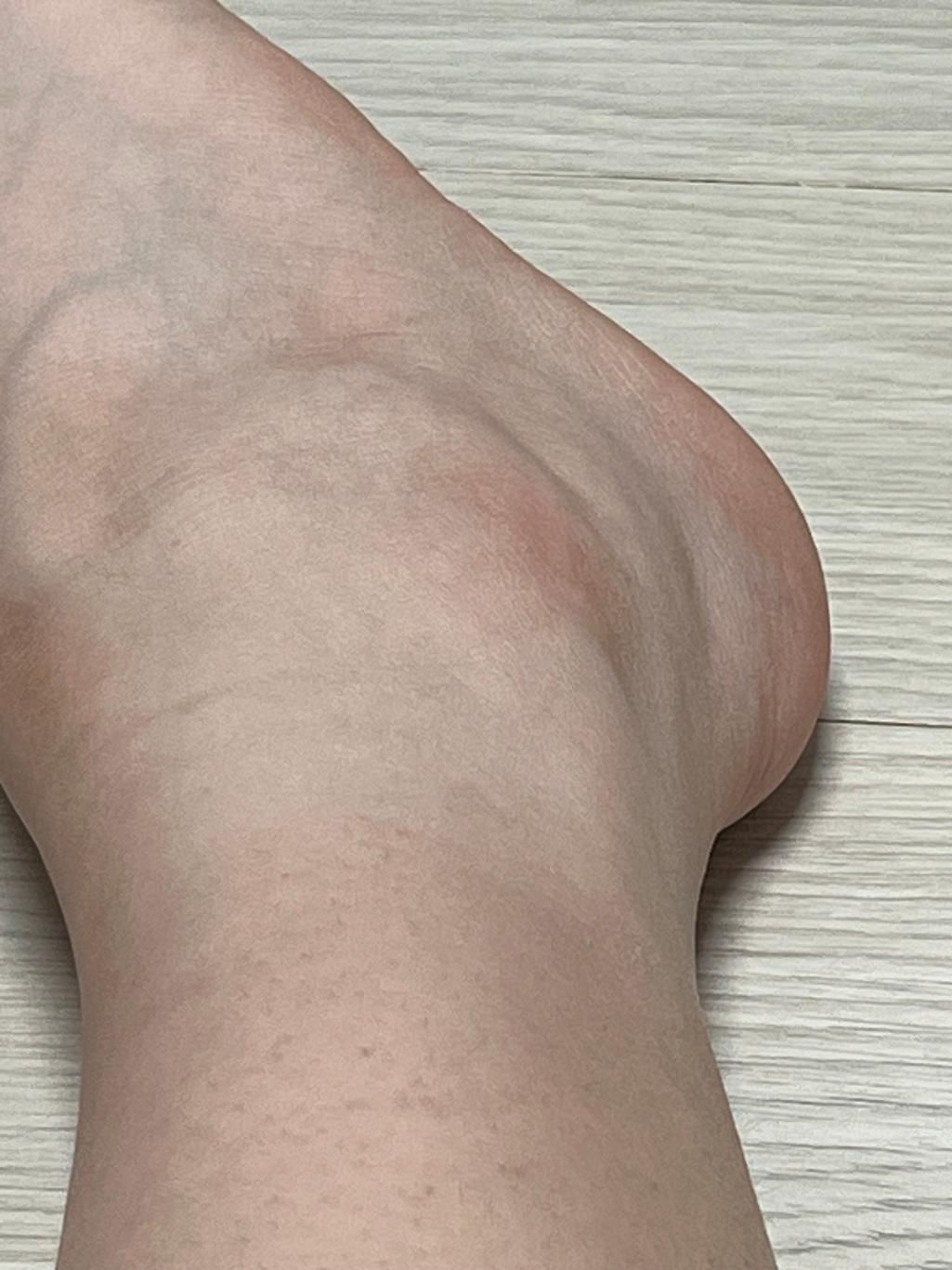 3번 째 사진
