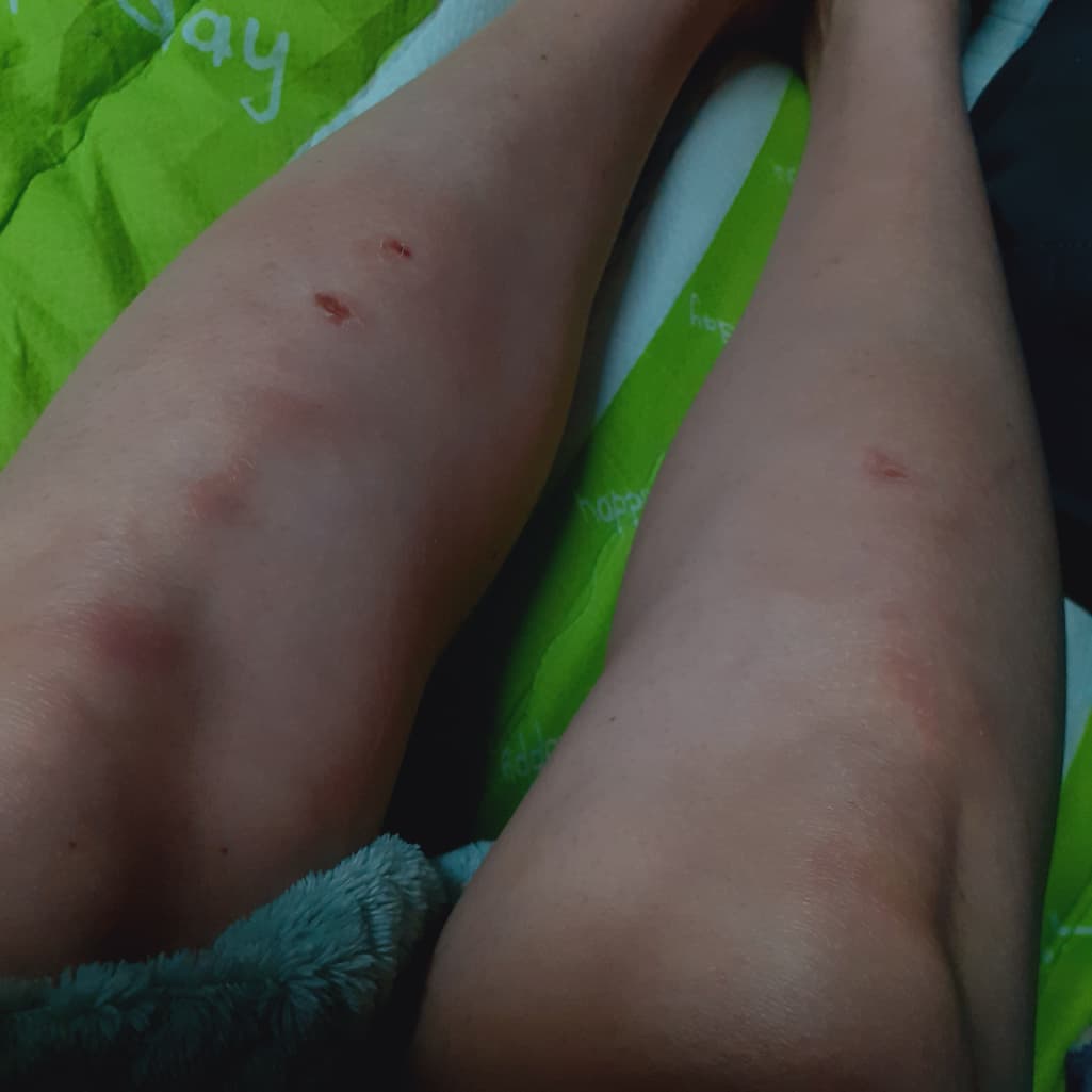 2번 째 사진