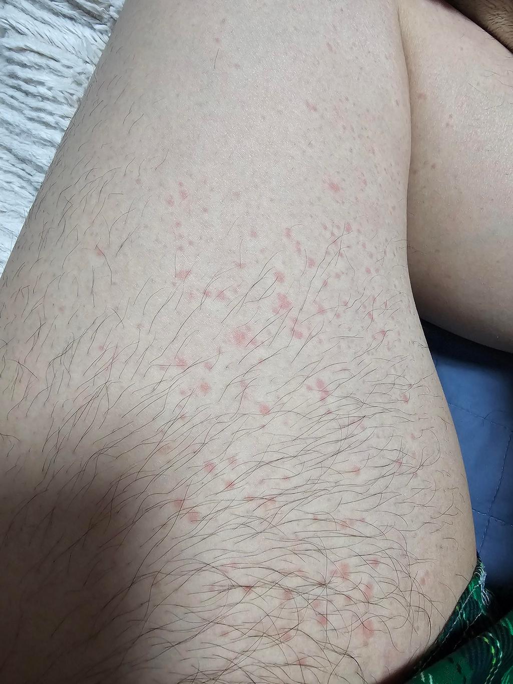 3번 째 사진