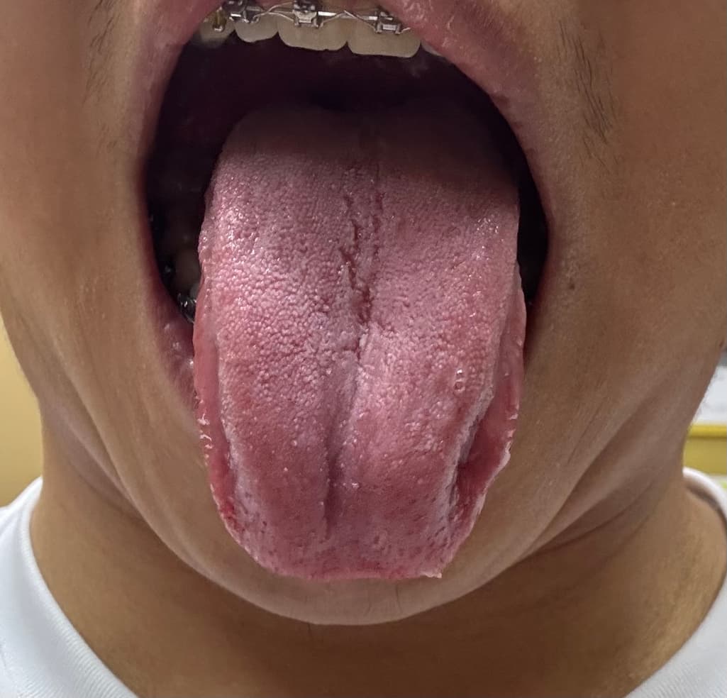 4번 째 사진