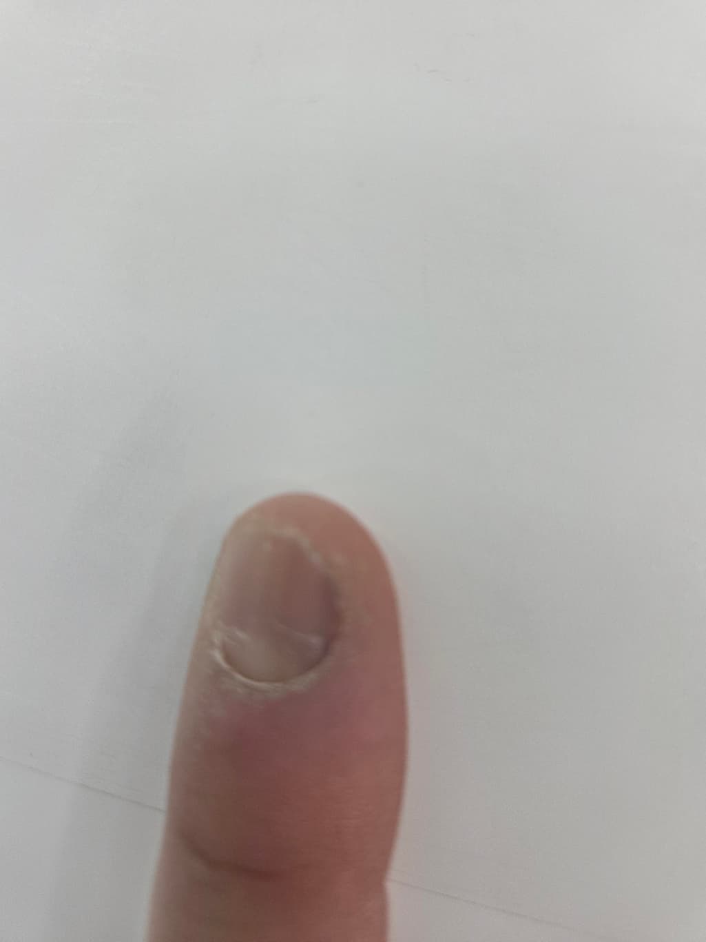 2번 째 사진