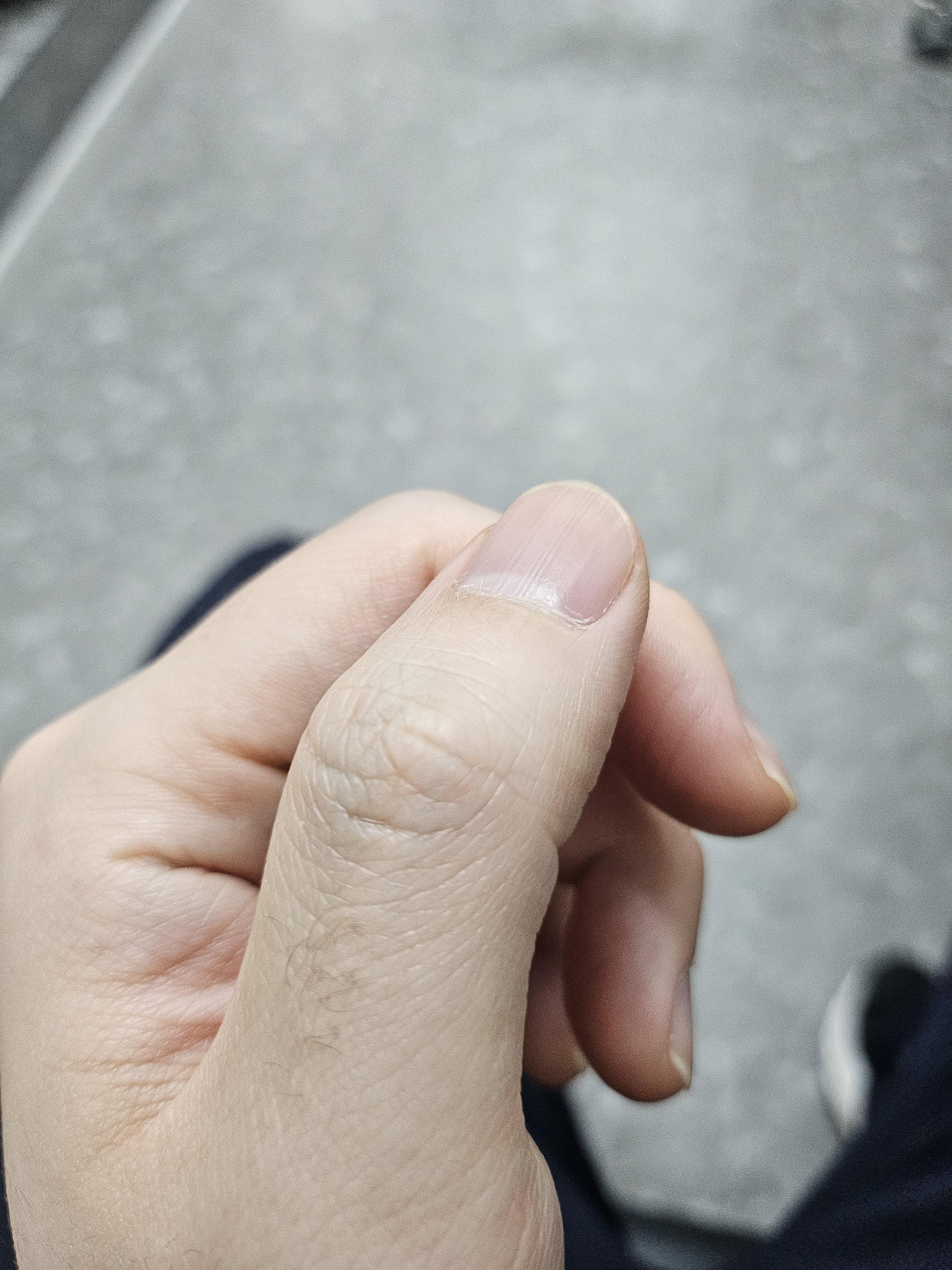 2번 째 사진