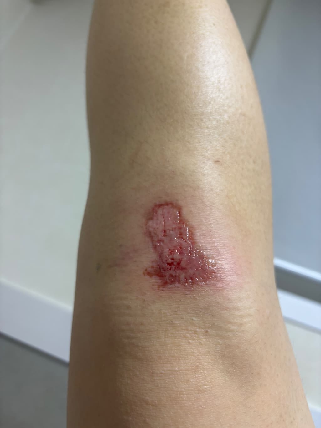 2번 째 사진