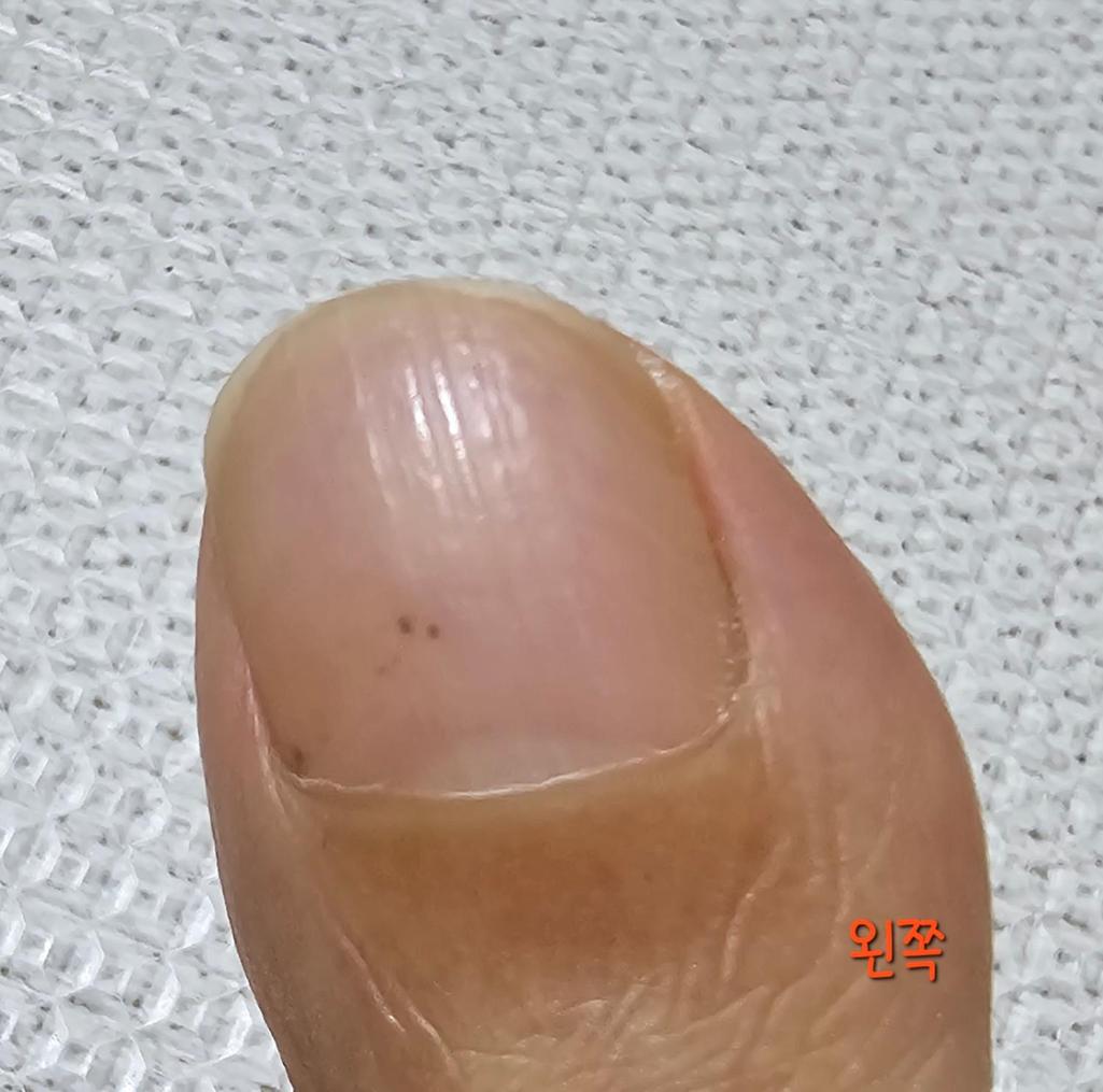 2번 째 사진