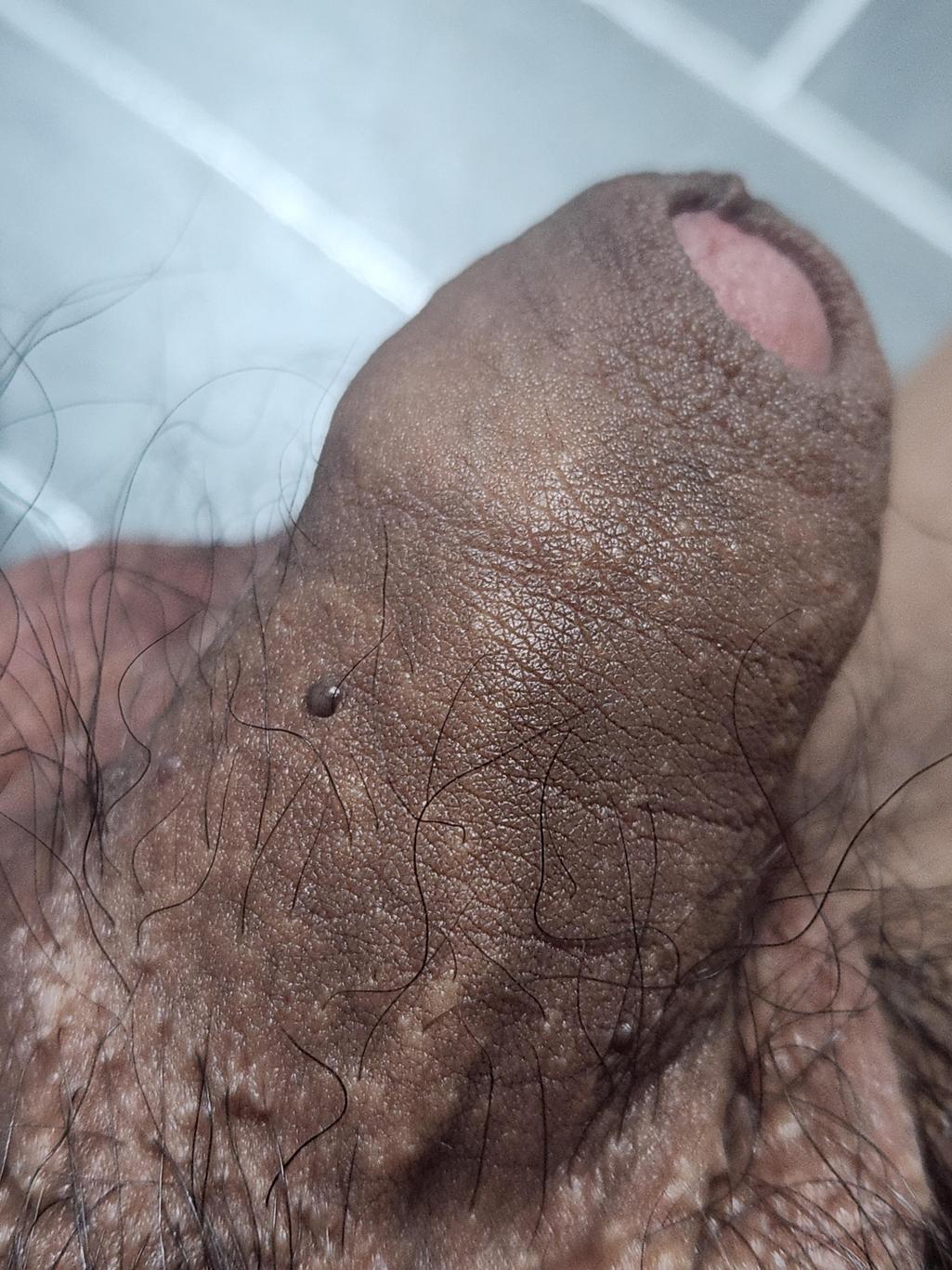 2번 째 사진