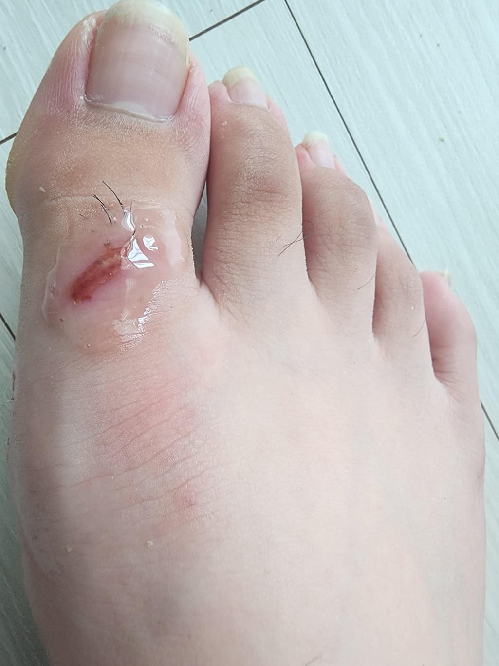 1번 째 사진