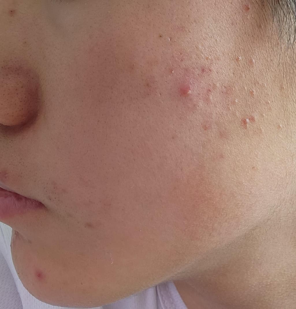 3번 째 사진