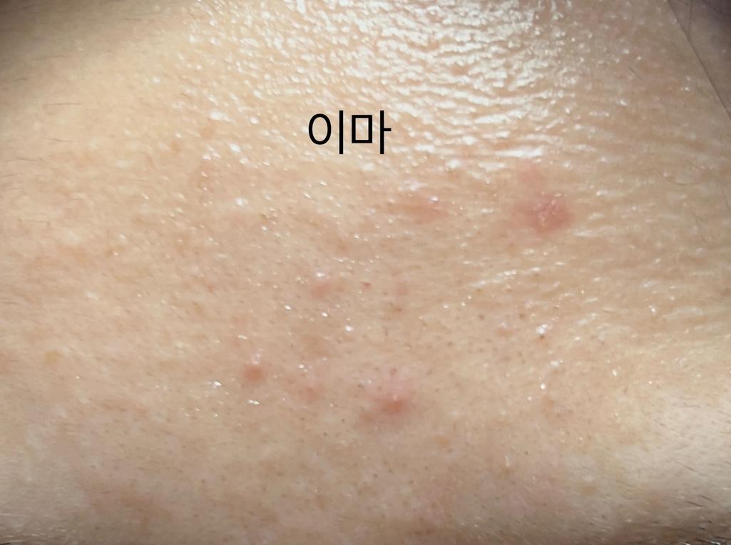 4번 째 사진