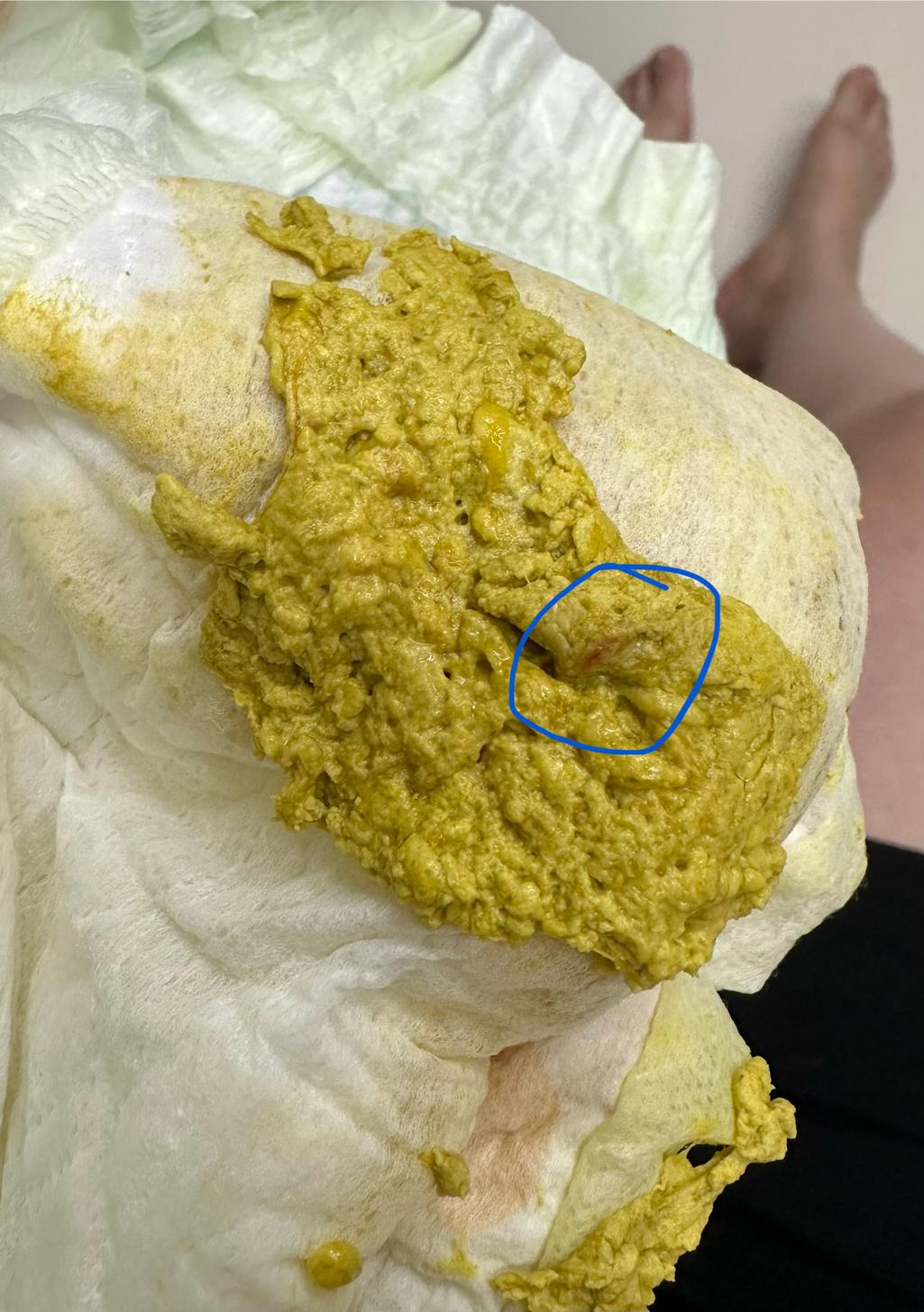 2번 째 사진