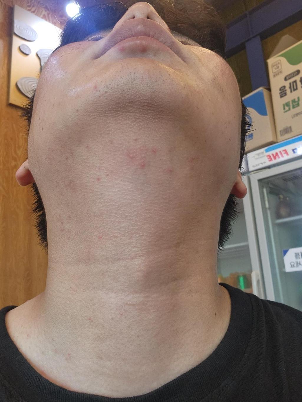 2번 째 사진